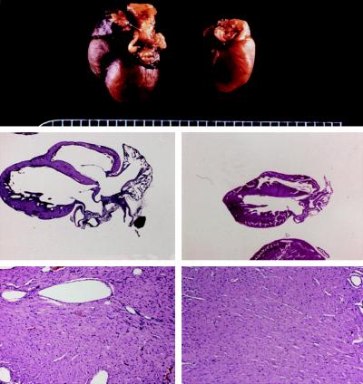 Pathologic examination of a Gαq-25/Gαq-40 dual-heterozygote that developed congestive heart failure (Left) and a nontransgenic sibling (Right). (Top) Gross examination revealed massive cardiomegaly of transgenic heart (×1.8). (Middle) Four-chamber section of hearts (×1.8) demonstrates massive enlargement of both ventricles and atria with atrial filling by organized thrombus. (Bottom) Cardiac histology (left ventricular free wall, ×18) shows mild edema and pale, hypertrophied myocytes without significant inflammation in transgenic heart. Results are representative of three dual-heterozygous mice that exhibited spontaneous cardiac decompensation.