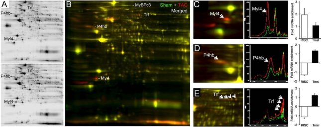 Changes in the cardiac proteome 1 wk after surgical pressure overloading. (A) Representative 2D differential in-gel electrophoresis showing Cy 3-labeled sham-operated (Upper) and Cy 5-labeled 1-wk TAC (Lower) cardiac proteomes. (B) Merged Cy 3 (green) and Cy 5 (red) images. Regulated myosin-binding protein C (MyBPc3), transferrin (Trf), protein disulfide isomerase (P4hb), and myosin light-chain isoform 4 (Myl4) are labeled. (C–E) Exploded views from a separate experiment of Myl4 (C), P4hb (D), and Trf (E), with accompanying quantifications corresponding to RISC-associated versus total mRNA levels.